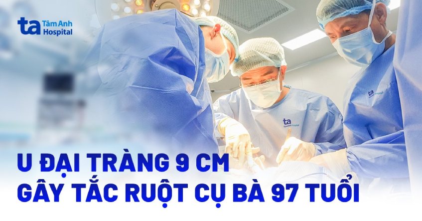 U đại tràng 9cm gây tắc ruột cụ bà 97 tuổi