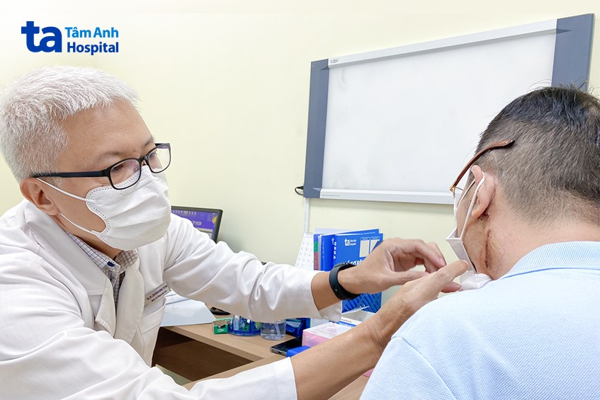 U lành nhưng dễ gây liệt mặt