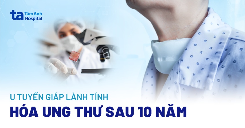 U tuyến giáp lành hóa ung thư sau 10 năm