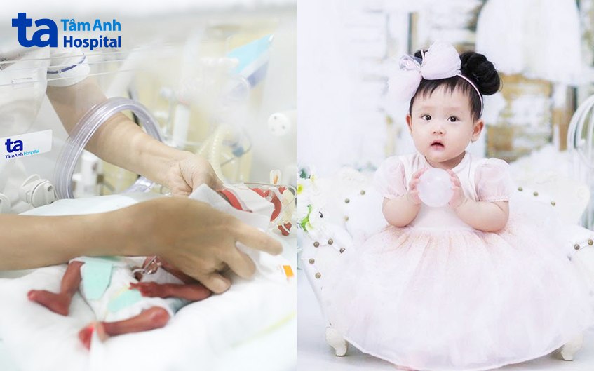 Bé Bối Bối sinh non ở tuần 25 hiện gần 3 tuổi phát triển khỏe mạnh