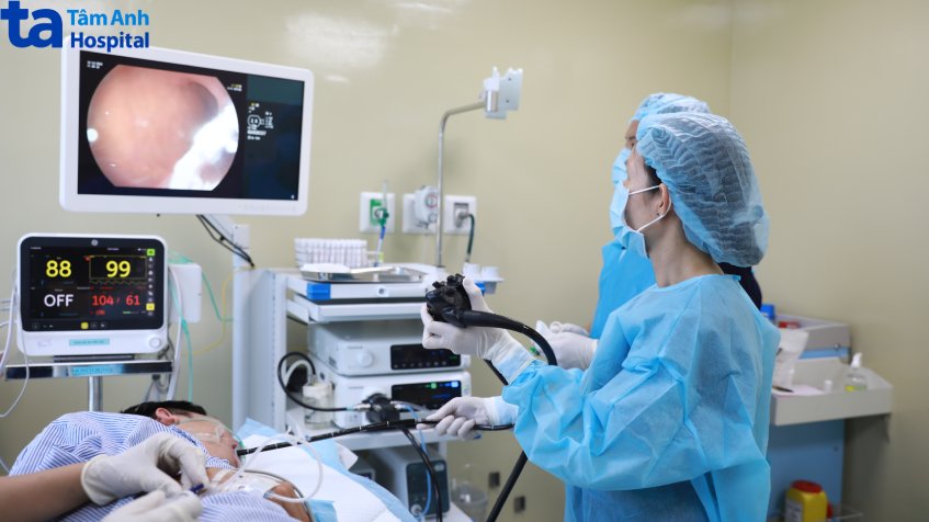 ca nội soi gắp xương cá