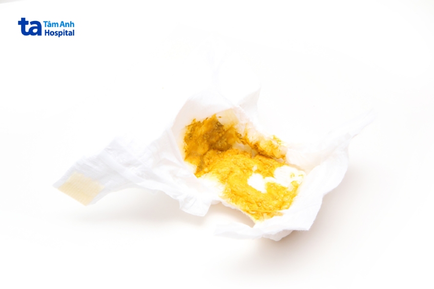 Các cách điều trị tiêu chảy ở trẻ sơ sinh khác