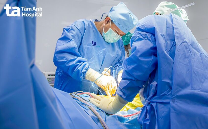 can thiệp phẫu thuật nội soi viêm phúc mạc