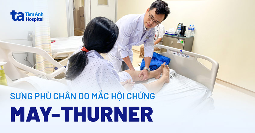 Chân sưng to do hàng trăm cục huyết khối “chặn” tĩnh mạch đùi