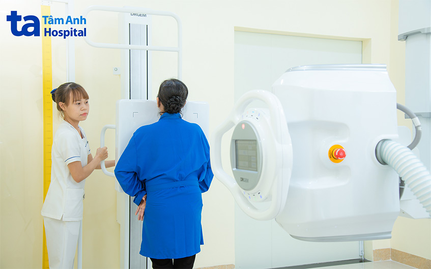 Chụp X-quang tim phổi chẩn đoán suy tim độ 2 và phát hiện các bất thường ở tim, phổi, lồng ngực