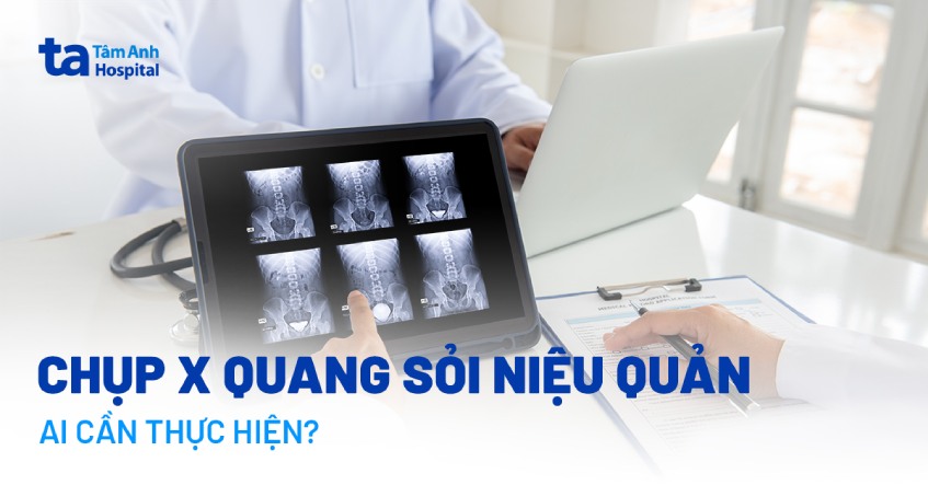 Chụp X quang sỏi niệu quản: Quy trình thực hiện như thế nào?