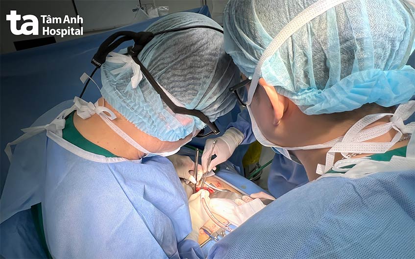 Ê kíp phẫu thuật lấy khối u tế bào khổng lồ cho bệnh nhân