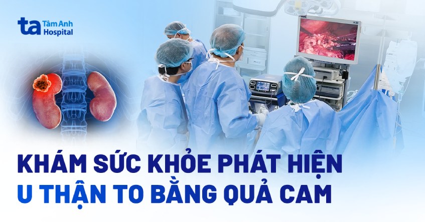 Khám sức khỏe phát hiện u thận to bằng quả cam