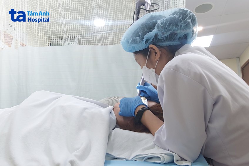 laser pico xóa xăm chân mày cho bệnh nhân