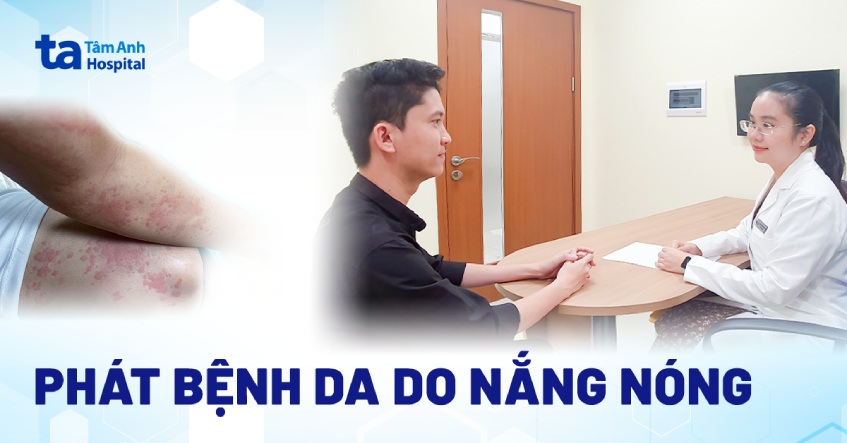 nhiều người mắc bệnh da do nắng nóng