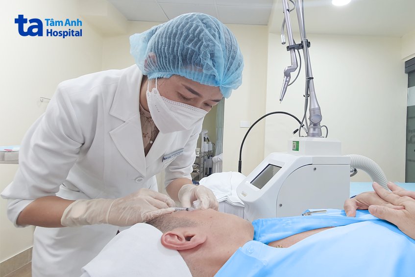 tiêm botox xóa nhăn cau mày