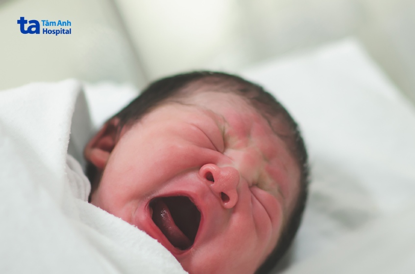 Trẻ sơ sinh quấy khóc do tiêu chảy khó chịu
