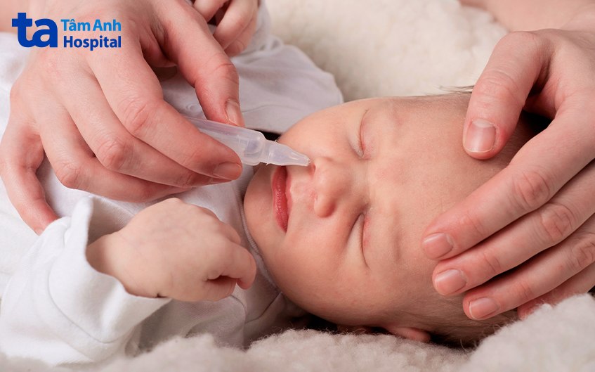 Vệ sinh mũi cho trẻ sơ sinh theo hướng dẫn của bác sĩ