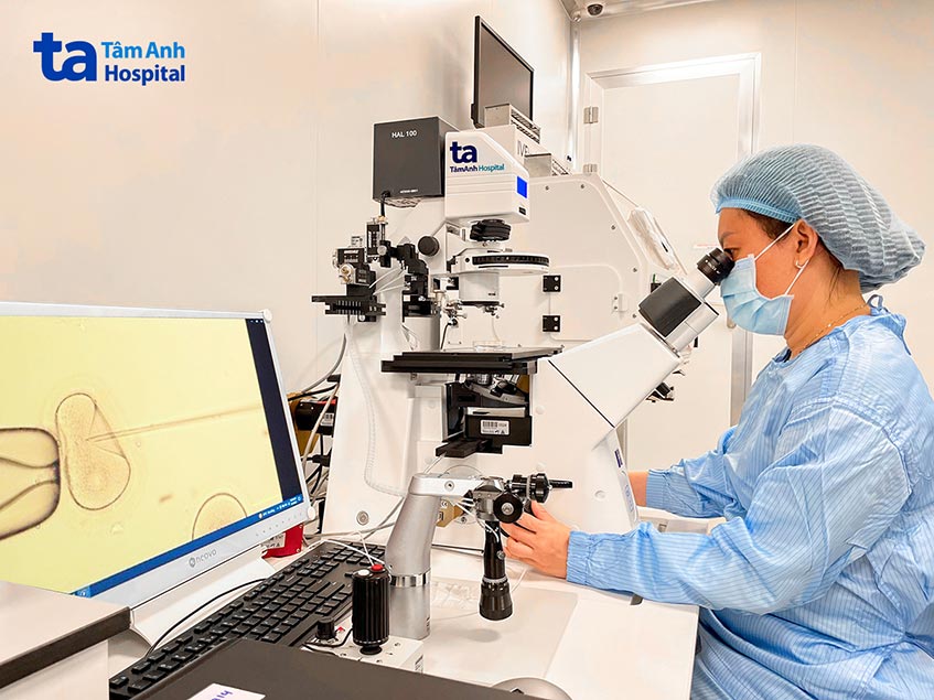 Thạc sĩ Nguyễn Ngọc Quỳnh - Trưởng Lab, Trung tâm Hỗ trợ sinh sản IVFTA tỉ mẩn thực hiện kỹ thuật tiêm tinh trùng vào bào tương trứng (ICSI)