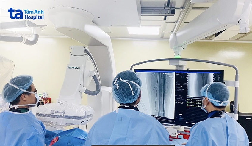 Bác sĩ Tuyến (ngoài cùng bên trái) cùng ê kíp can thiệp làm sạch huyết khối ở động mạch khoeo trái cho bệnh nhân