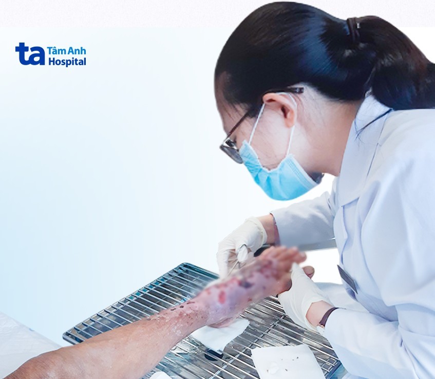 Bác sĩ Tuyền đang cắt lọc vết thương cho ông H