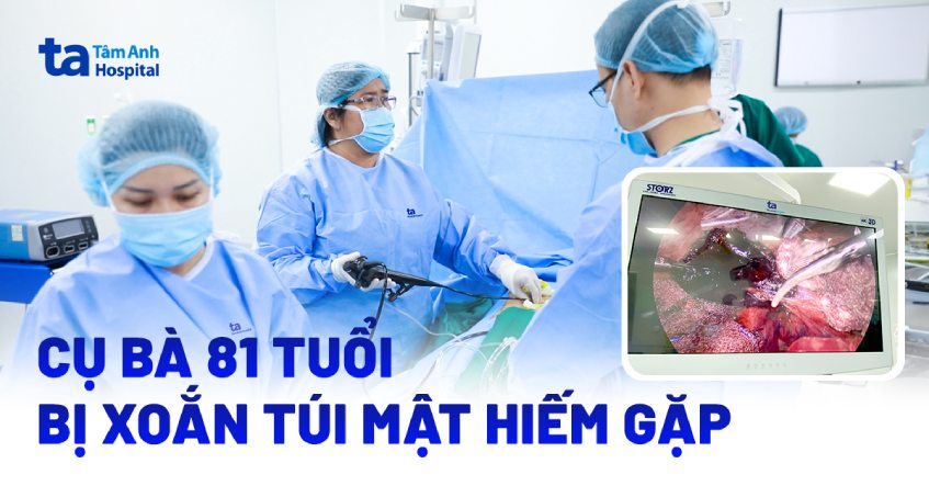 Cụ bà 81 tuổi bị xoắn túi mật hiếm gặp
