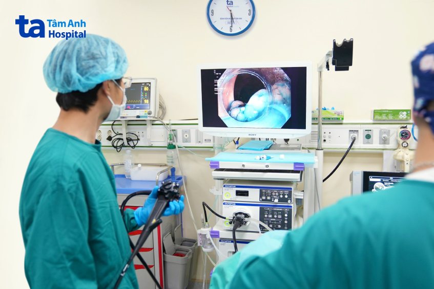 ca nội soi ESD