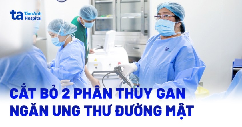 cắt bỏ 2 phân thùy gan