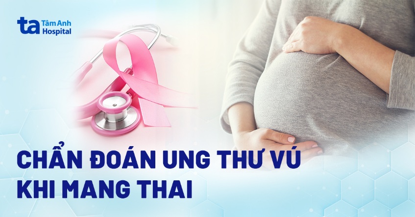 4 phương pháp chẩn đoán ung thư vú khi mang thai (có bầu) và lưu ý
