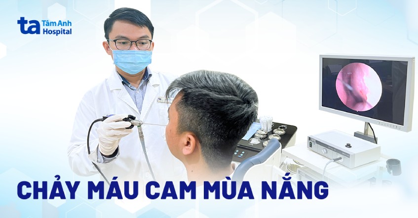chảy máu cam mùa nắng