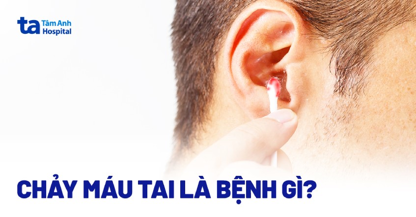 Chảy máu tai: Nguyên nhân, dấu hiệu và cách phòng ngừa