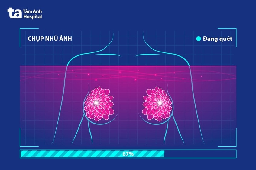 chụp nhũ ảnh tăng cường tương phản