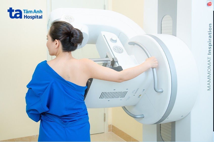 Lợi ích của việc tầm soát ung thư vú