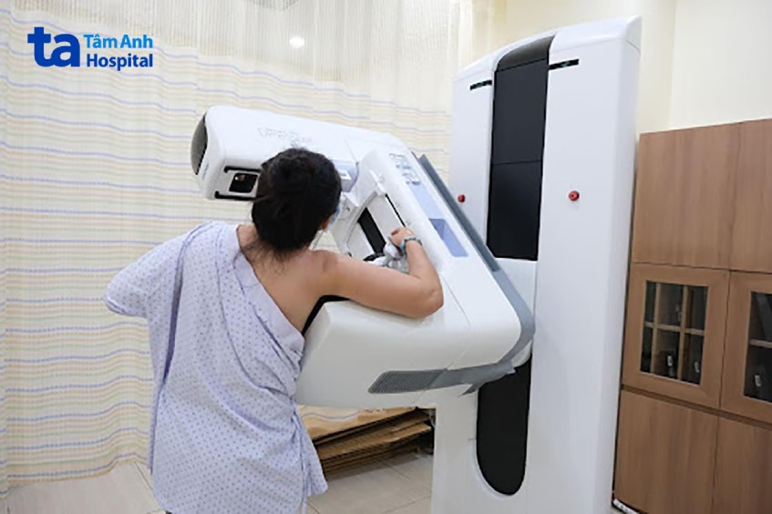 máy DBT kỹ thuật số Mammomat Inspiration