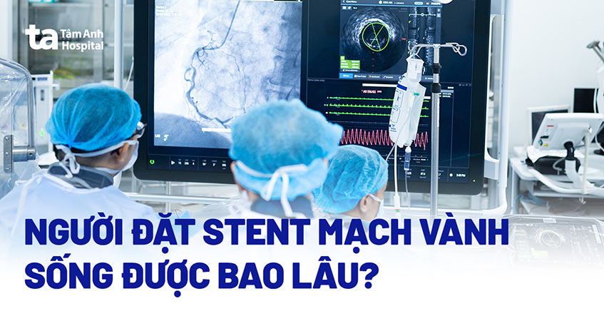 Người đặt stent mạch vành sống được bao lâu? Thời gian tồn tại stent?