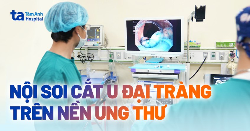 nội soi cắt u đại tràng trên nền ung thư