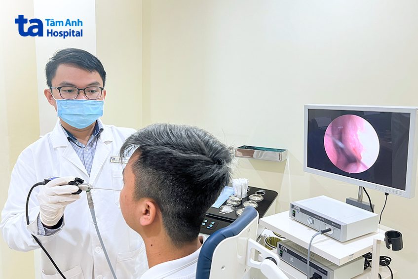 nội soi kiểm tra chảy máu cam