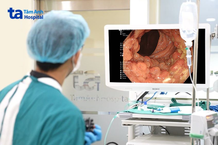 nội soi thấy khối sùi loét