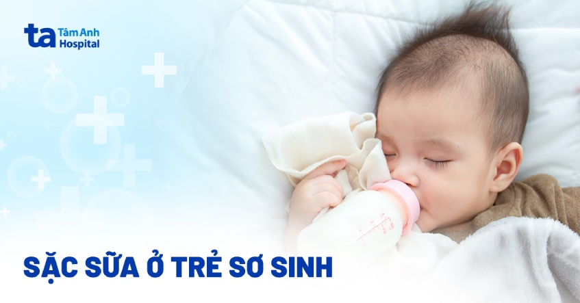 Sặc sữa ở trẻ sơ sinh: Nguyên nhân, dấu hiệu và cách phòng tránh