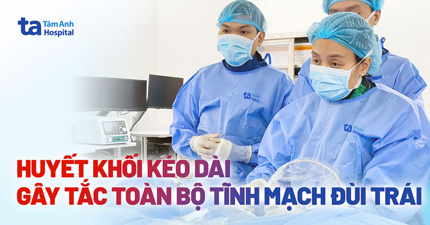 Tắc toàn bộ tĩnh mạch đùi trái do huyết khối