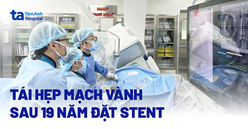Tái hẹp mạch vành sau 19 năm đặt stent