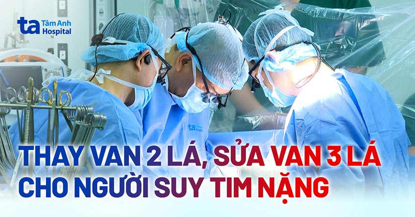 Thay van 2 lá, sửa van 3 lá cho người suy tim nặng