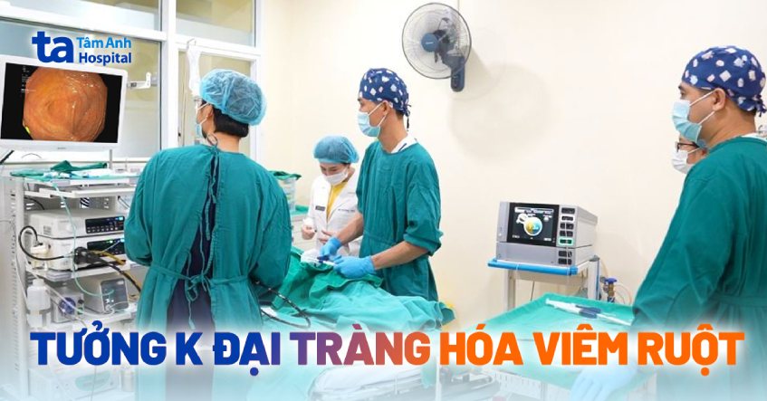 Tưởng mắc ung thư đại tràng hóa viêm ruột