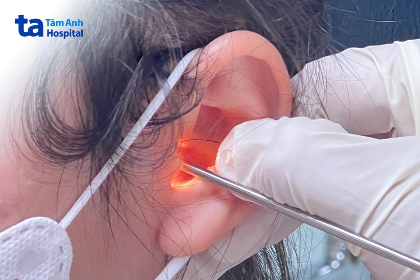 bác sĩ nội soi tai cho bệnh nhân