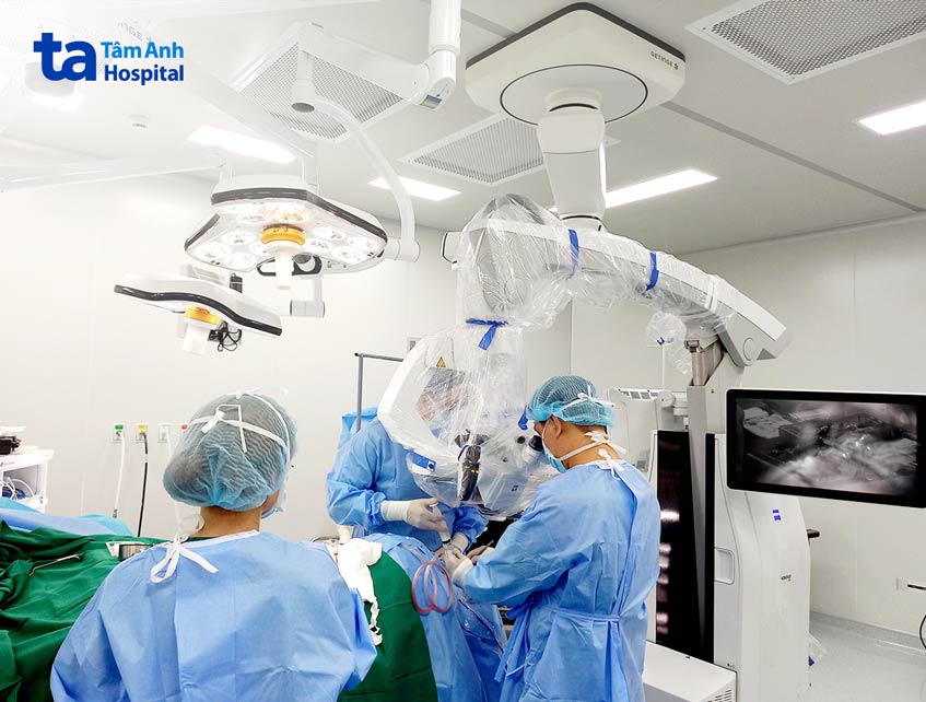 Bác sĩ đang bóc tách động mạch tiểu não ra khỏi dây thần kinh số 7 cho bà Hương