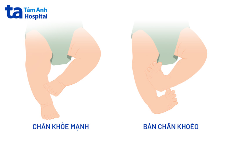 Bệnh tiềm ẩn nguy hiểm