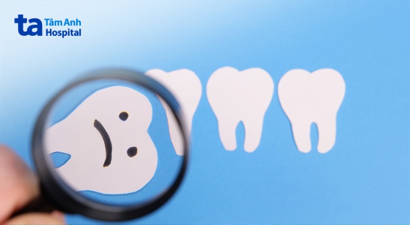 Đối tượng có nguy cơ bị viêm lợi trùm