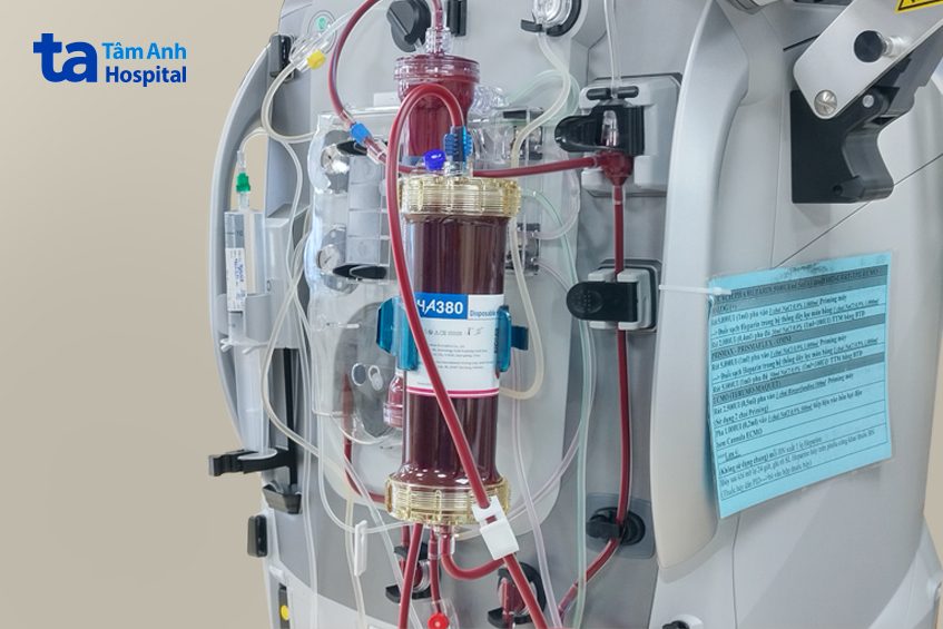 bộ lọc máu hấp phụ tại bvdk tâm anh