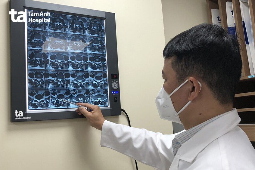 bs phân tích tập gym sai cách cô gái phải mổ cột sống