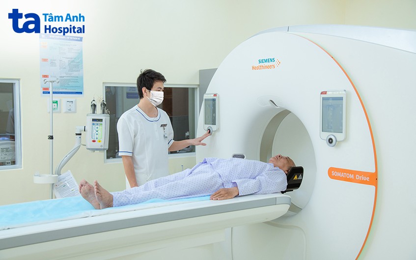 chẩn đoán sỏi ống mật chủ
