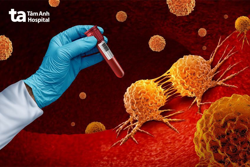chẩn đoán ung thư bằng xét nghiệm máu