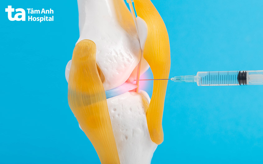 chỉ định phân tích dịch khớp