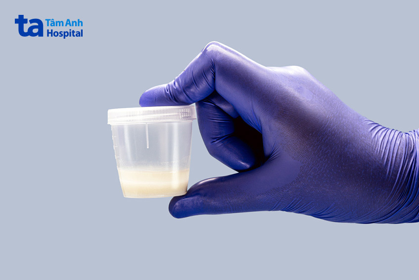 Đàn ông bị tinh trùng loãng có sao không?