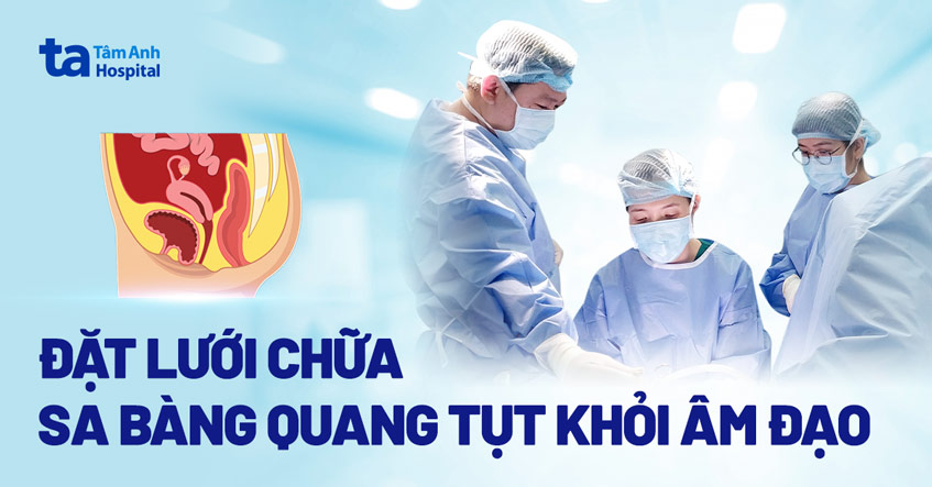 Đặt lưới chữa sa bàng quang tụt khỏi âm đạo