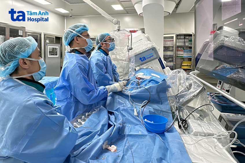 Bác sĩ Minh (ngoài cùng bên phải) cùng ê kíp can thiệp đặt stent cho bệnh nhân “tắc kép” hai nhánh mạch vành